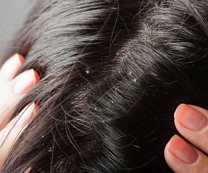 паста сульсена для роста волос отзывы