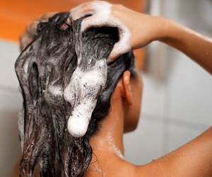 волосы быстро становятся жирными что делать