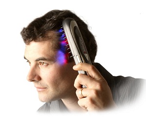 очаговое облысение