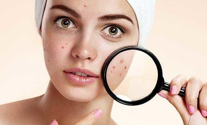 Косметика для всех типов кожи: как выбрать косметику для лечения акне и других проблем кожи