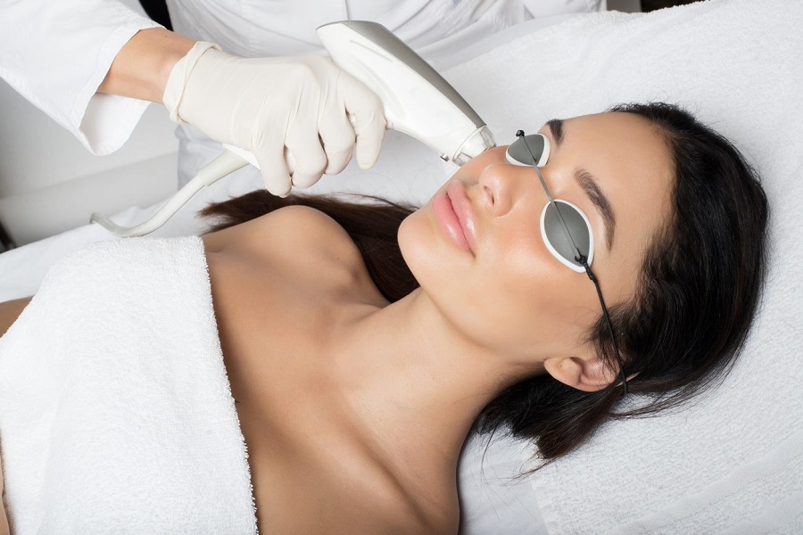 Лазерный пилинг лица
