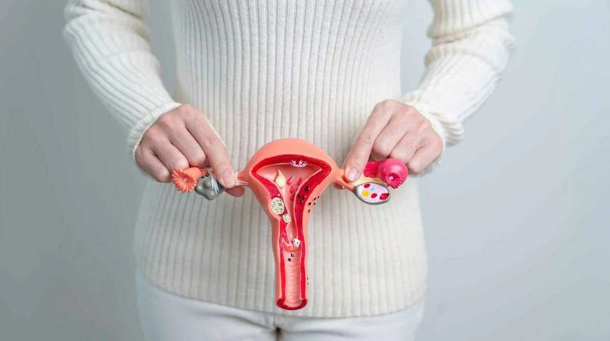 Понимание миомы матки: руководство по расширению возможностей