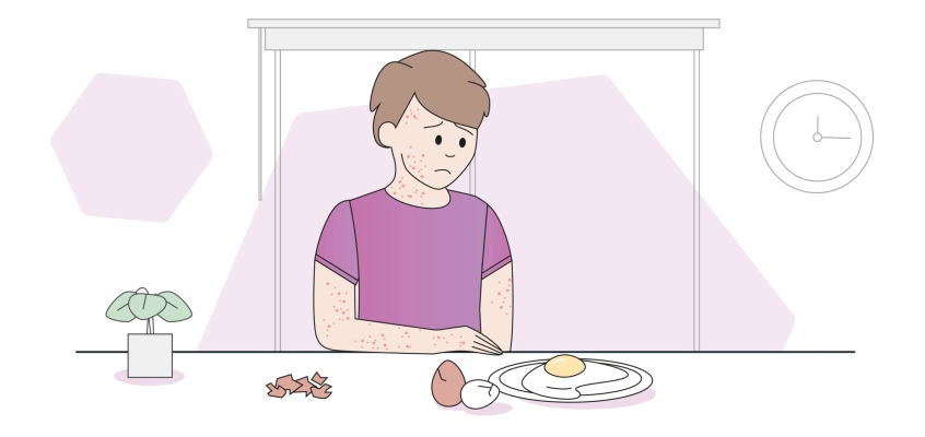 Диагностика и проявления аллергии на яйца