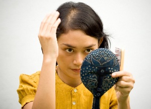 Эстетическая и психологическая проблема — облысение у женщин: причины и лечение, фото, полезные советы и рекомендации как бороться с облысением у женщин