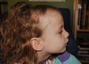 Почему выпадают волосы и как лечить алопецию у детей: методы лечения медикаментами и средствами народной медицины, профилактические рекомендации как лечить выпадение волос у детей