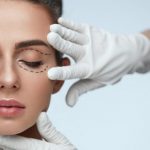 Блефаропластика: виды, особенности и показания к ней