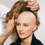 СИСТЕМА ЗАМЕЩЕНИЯ ВОЛОС