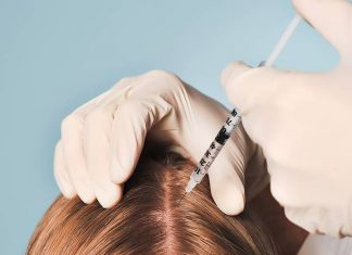 Решение проблемы выпадения волос: как работает мезотерапия