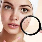 Косметика для всех типов кожи: как выбрать косметику для лечения акне и других проблем кожи