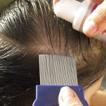 Диагностика вшей