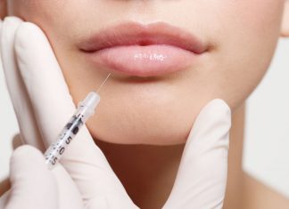Плюсы увеличения губ с помощью гиалуронки