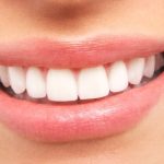 Как происходит имплантация зубов