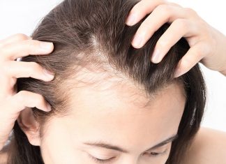 Постковидный синдром: как предотвратить выпадение волос после болезни?