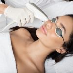 Лазерный пилинг лица