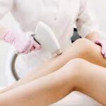 Чудеса лазерной эпиляции: подробное руководство