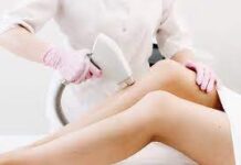 Чудеса лазерной эпиляции: подробное руководство