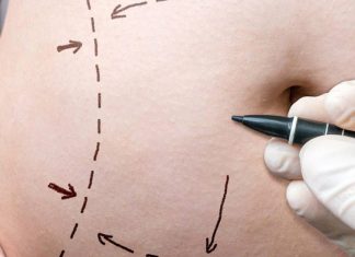 Бариатрическая хирургия: преобразующее решение для снижения веса