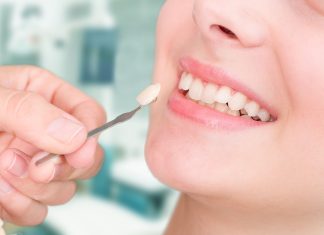 Художественная реставрация зубов: сочетание искусства и стоматологии