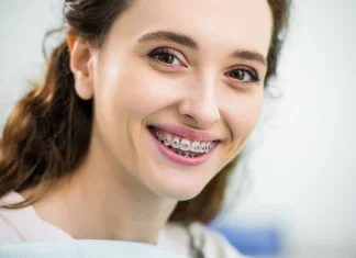 Добейтесь уверенной улыбки с брекетами: выпрямите зубы без проблем!