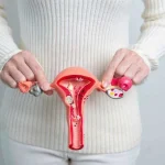 Понимание миомы матки: руководство по расширению возможностей