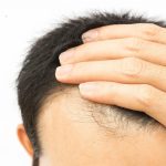 Повысьте свою уверенность с помощью операции по пересадке волос