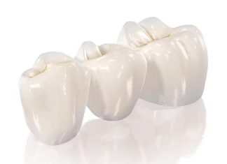 Виды зубных коронок