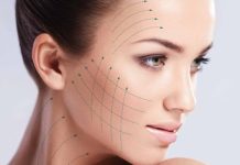 Что такое мезотерапия?