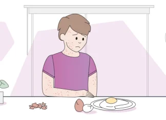 Диагностика и проявления аллергии на яйца