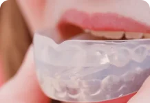 Ночные капы от бруксизма: защита зубов во сне