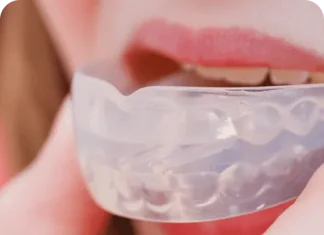 Ночные капы от бруксизма: защита зубов во сне