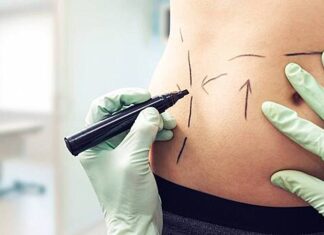 Хирург объяснил, почему люди часто меняют внешность после сезона отпусков