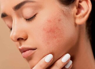 Осенние капризы кожи: почему так происходит и как помочь при атопии и аллергиях