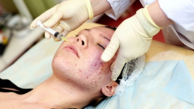 Топ−3 главных бьюти-процедуры 2025 года