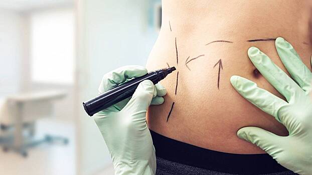 Хирург объяснил, почему люди часто меняют внешность после сезона отпусков