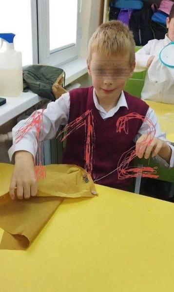 В Сочи две хаски разорвали лицо 9-летнему мальчику — отец собирал фрагменты губ и носа